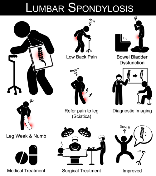 Ensemble de vecteur infographique médical de personnes 03 personnes medical infographie   